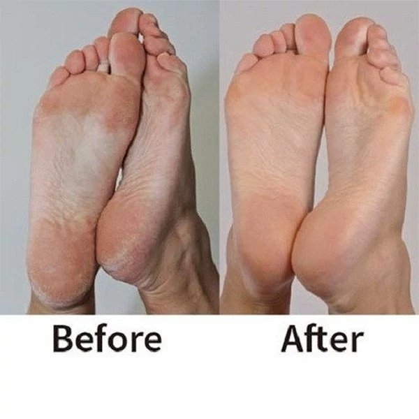 سنگ پا شارژی